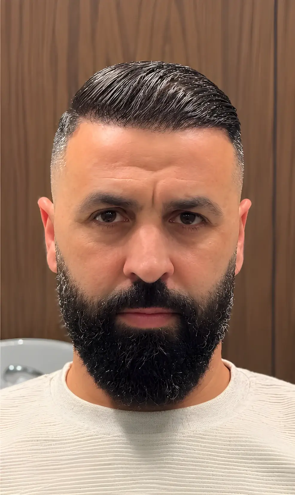 Nachher: derselbe Mann mit neuer, natürlicher Haarlinie nach der Haartransplantation