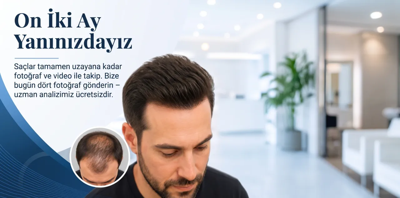 Sık saçlı ve doğal saç çizgili adam, yuvarlakta önceki durum